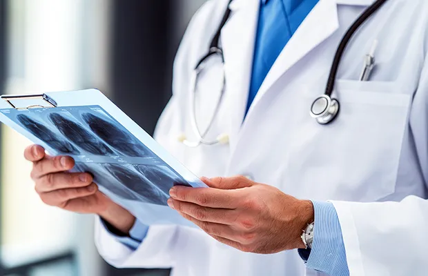 A photo of a medical professional holding a set of x-rays.